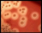 Streptococcus pyogenes